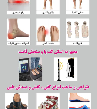 بهترین و تخصصی ترین مرکز اسکن کف پا تهران